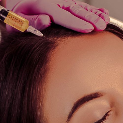 PRP-hair-treatment-gurgaon