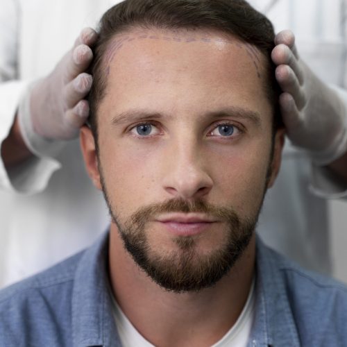 adult-male-doing-follicular-unit-extraction
