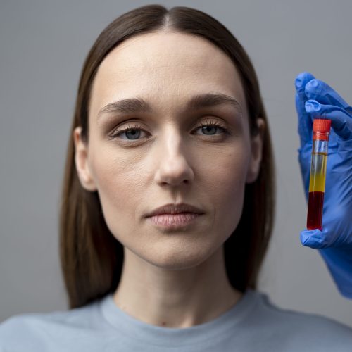 front-view-woman-prp-vial