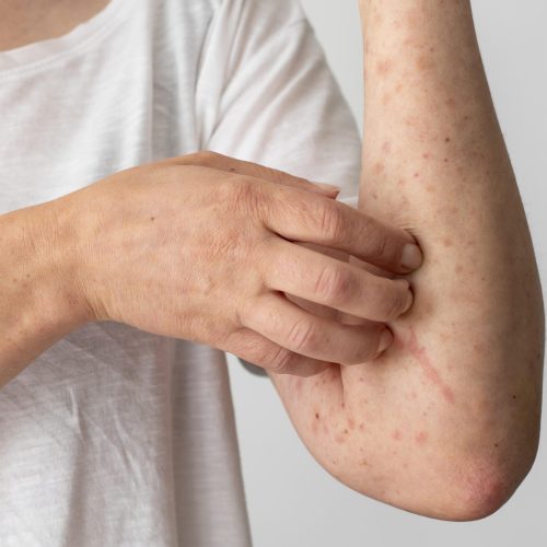 skin-allergy-reaction-person-s-arm