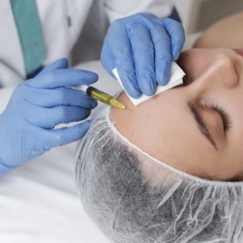 woman-getting-face-prp-treatment-high-angle